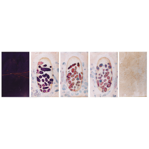 Trophozoide - 2001