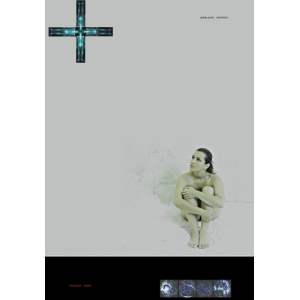 Bone scan - 2005
