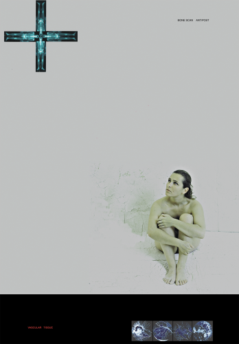 Bone scan - 2005