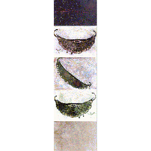 Giarda Intestinalis - 2001