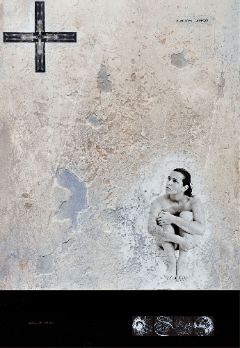 Bone Scan - 2012